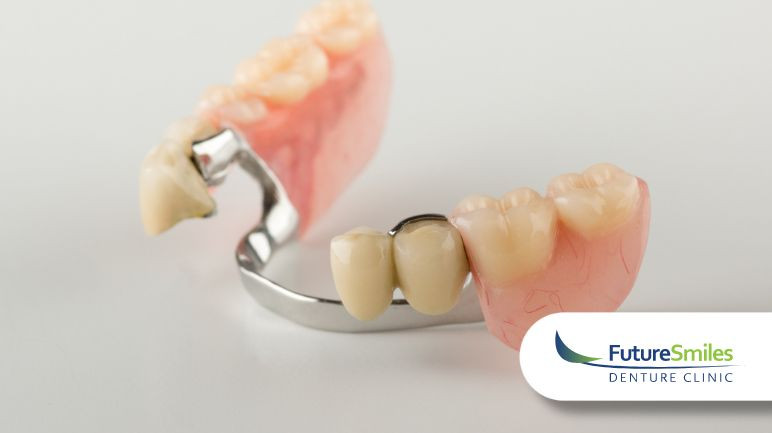 SE Partial Dentures: The Top 3 Signs You May Need Partial Dentures